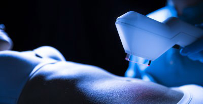 Cura Laser contro i Capillari del Viso