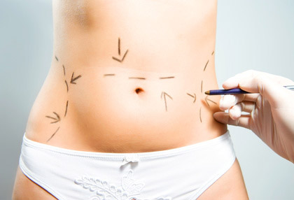 Medicina estetica non chirurgica per la riduzione di grasso localizzato.