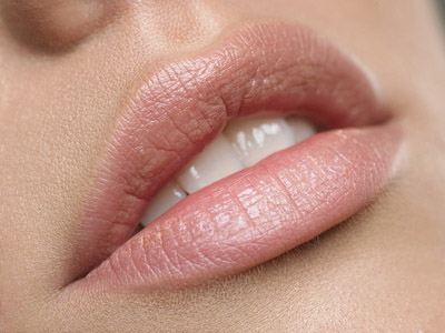Rimodellamento labbra con acido ialuronico